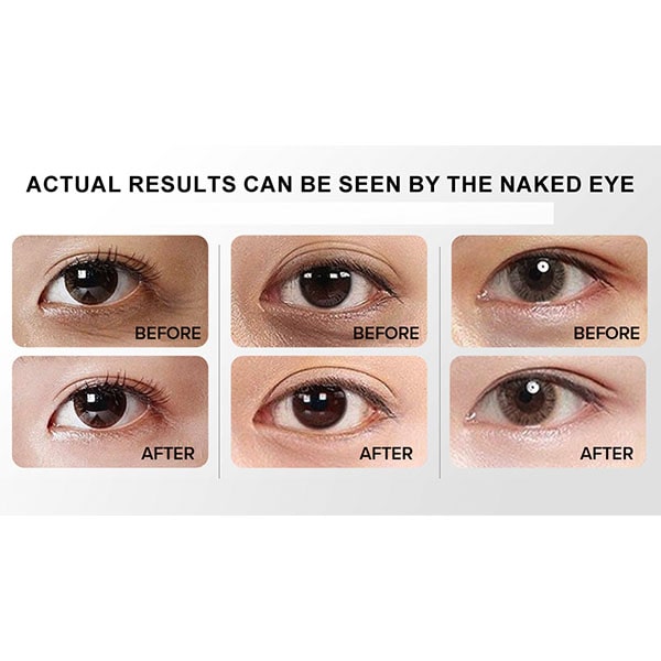 Eye Cream With Built-In Red Light Massager