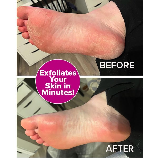 Instant Foot Peeling Mask