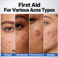 Four close-up images of skin showing pimples, hormonal acne, and breakouts, each labeled with its type to help guide your choice of Dr. Leo Acne Buster spot treatment.