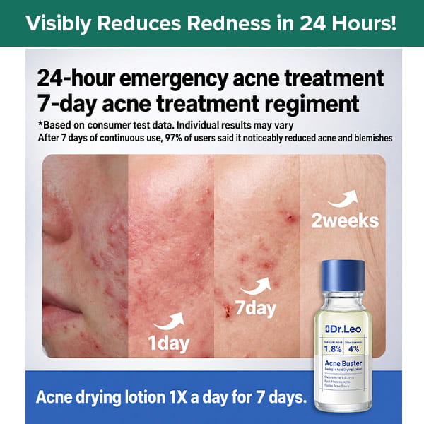 A bottle of Dr. Leo Acne Buster next to a progression of skin showing reduced redness and post-acne marks from day one to week two.