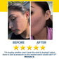 Before and after photos of a cheek showing a reduction in acne and post-acne marks after using Dr. Leo Acne Buster, accompanied by a five-star rating and a positive customer testimonial.