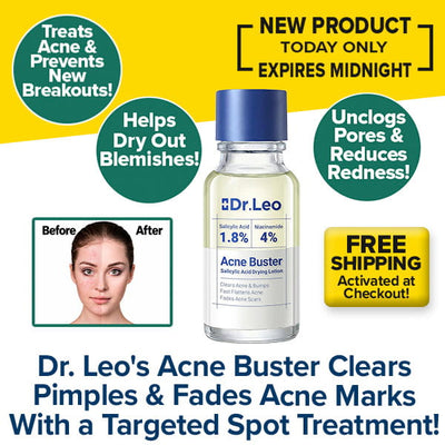 A bottle of Dr. Leo Acne Buster surrounded by text bubbles listing benefits, a before-and-after photo of a person’s face, and a promotional banner for free shipping.