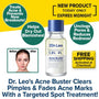 A bottle of Dr. Leo Acne Buster surrounded by text bubbles listing benefits, a before-and-after photo of a person’s face, and a promotional banner for free shipping.