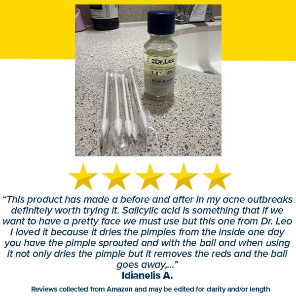 A bottle of Dr. Leo Acne Buster with a set of cotton swabs on a bathroom counter, positioned below five yellow stars and a customer review.