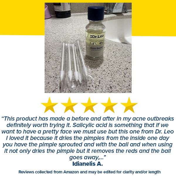A bottle of Dr. Leo Acne Buster with a set of cotton swabs on a bathroom counter, positioned below five yellow stars and a customer review.