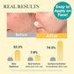 Kojic Acid Turmeric Brightening Gel Mask