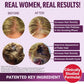Hair Growth Accelerator Soft Chews