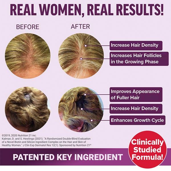 Hair Growth Accelerator Soft Chews