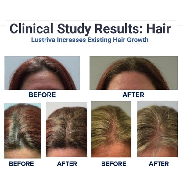 Hair Growth Accelerator Soft Chews
