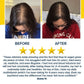 Hair Growth Accelerator Soft Chews