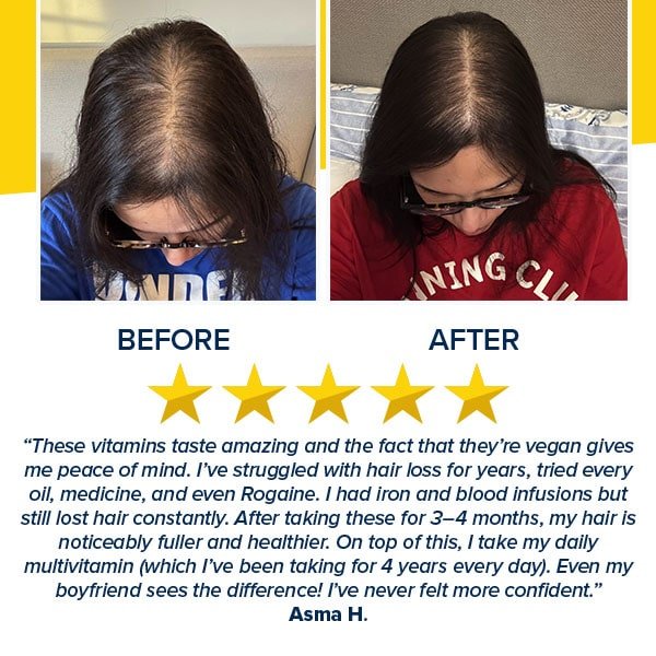 Hair Growth Accelerator Soft Chews
