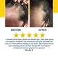 Hair Growth Accelerator Soft Chews