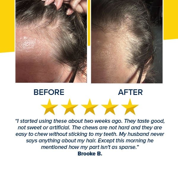 Hair Growth Accelerator Soft Chews