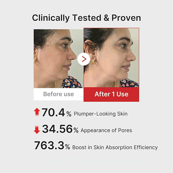 Side-by-side close-ups of a woman’s face before and after 1 use of Real Glass Glow Beauty Massager, highlighting stats: 70.4% plumper skin, 34.56% fewer pores, and a 763.3% boost in absorption efficiency for pore care.