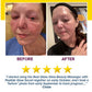 Side-by-side photos show a woman’s face before and after using the Real Glass Glow Beauty Massager: left—red, irritated skin; right—clearer, smoother skin. Five stars and a testimonial highlight improved pore care.